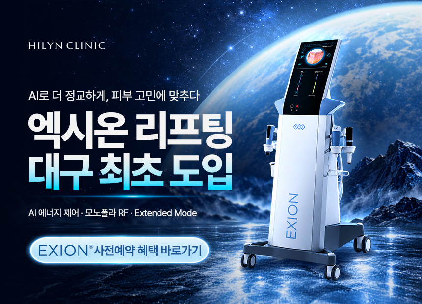 엑시온 사전예약 혜택